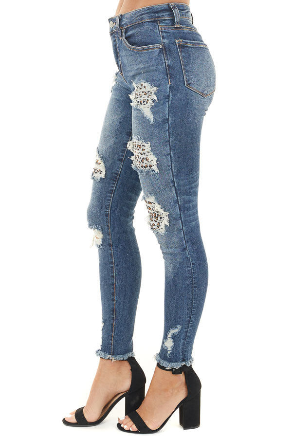 Dark Wash Denim Skinny Jeans with Distressed Leopard Print