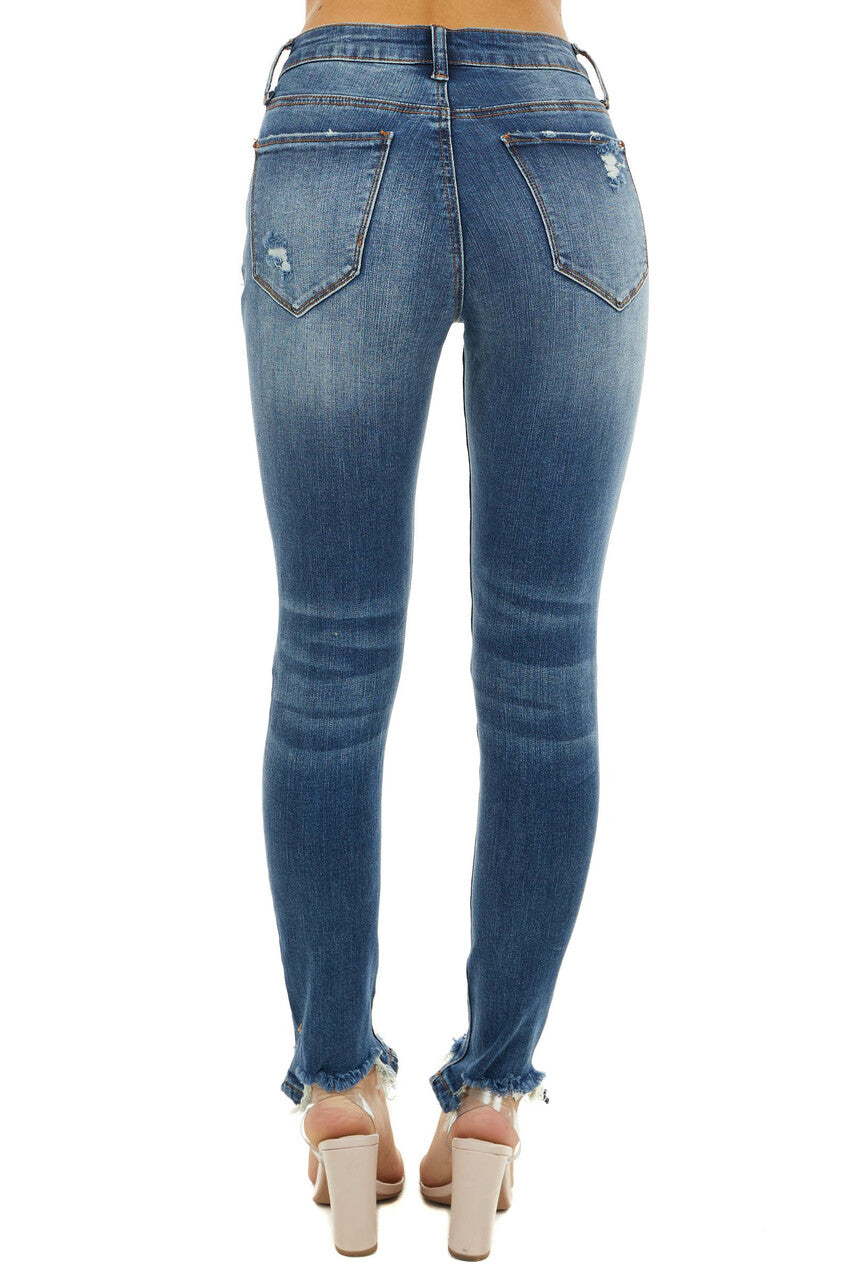 Dark Wash Mid Rise Skinny Jeans with Distressed Details 