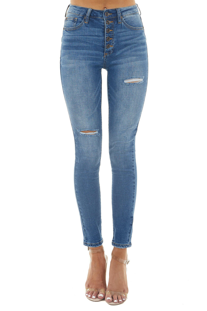 Medium Dark Wash High Rise Button Fly Skinny Jeans